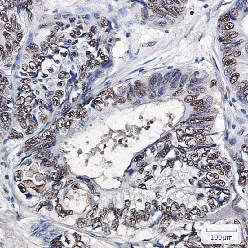 ANP32B Antibody