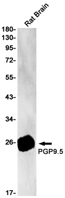 UCHL1 Antibody