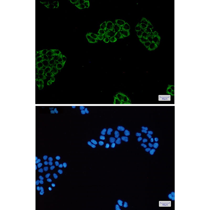 PGM1 Antibody