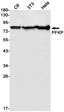PFKP Antibody