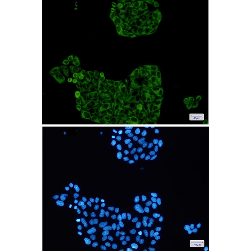 PFKP Antibody