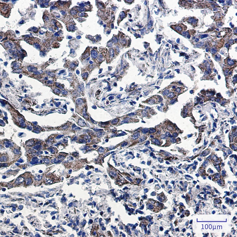 Peroxiredoxin 5 Rabbit mAb