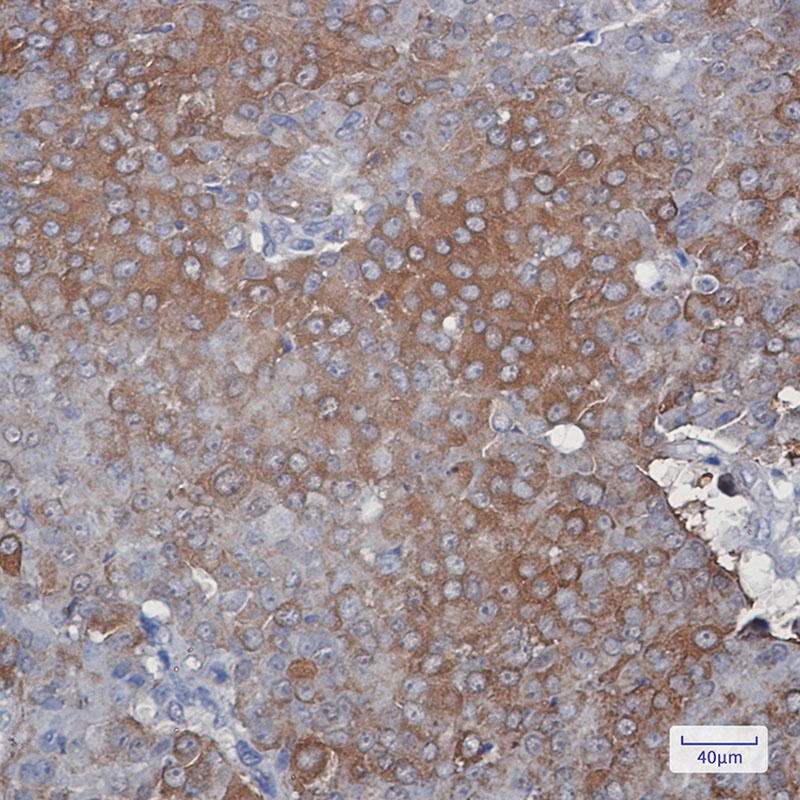 Peroxiredoxin 2 Rabbit mAb