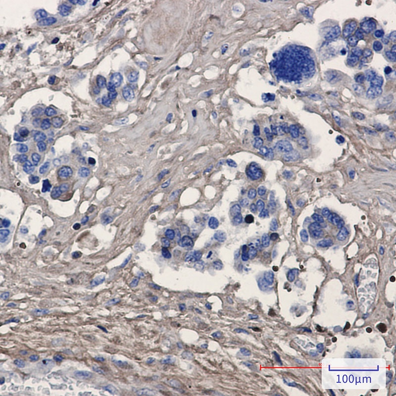 Periostin Rabbit Monoclonal Antibody