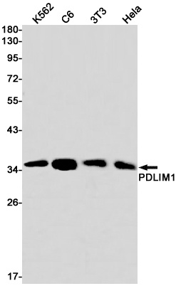 PDLIM1 Rabbit mAb