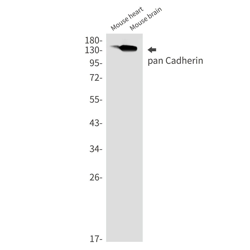 P cadherin Rabbit mAb
