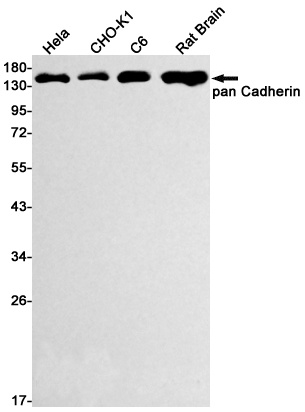 P cadherin Rabbit mAb
