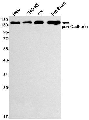 CDH1/CDH2/CDH3 Antibody