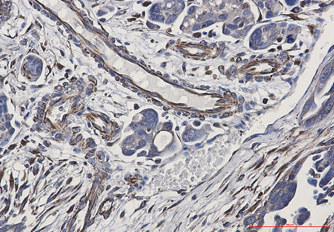 P cadherin Rabbit mAb