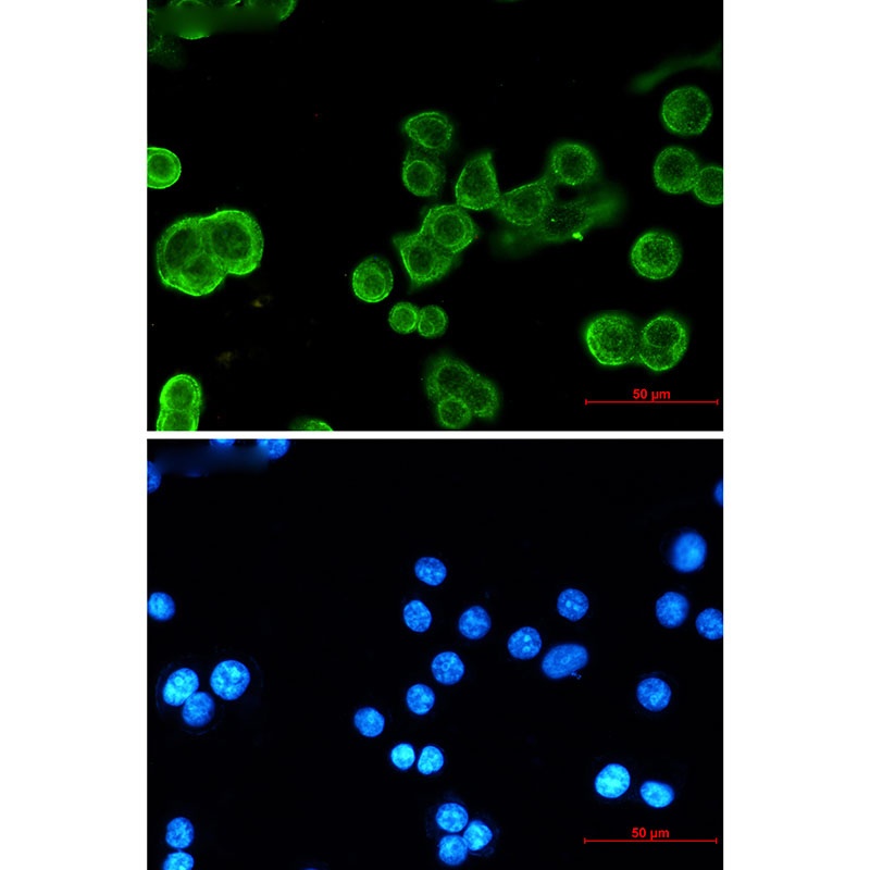 CDH1/CDH2/CDH3 Antibody