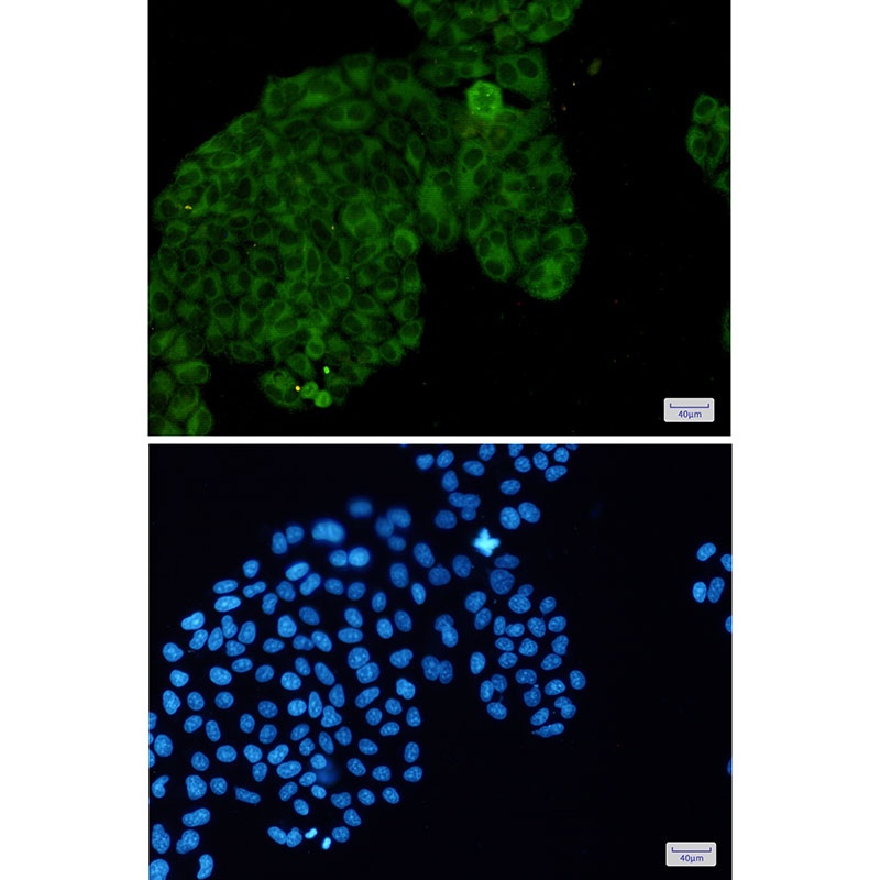 PAK3 Antibody