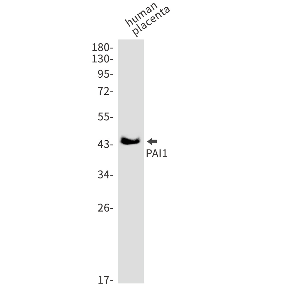 PAI1 Rabbit mAb