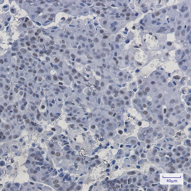 PABPN1 Rabbit mAb