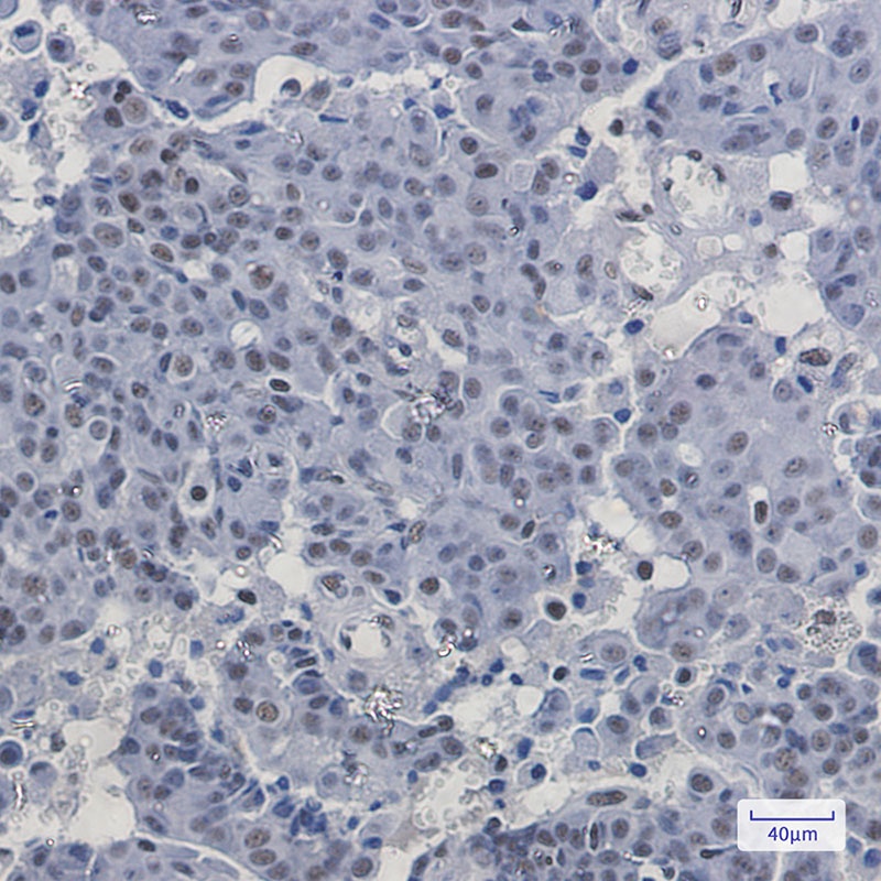 PABPN1 Antibody