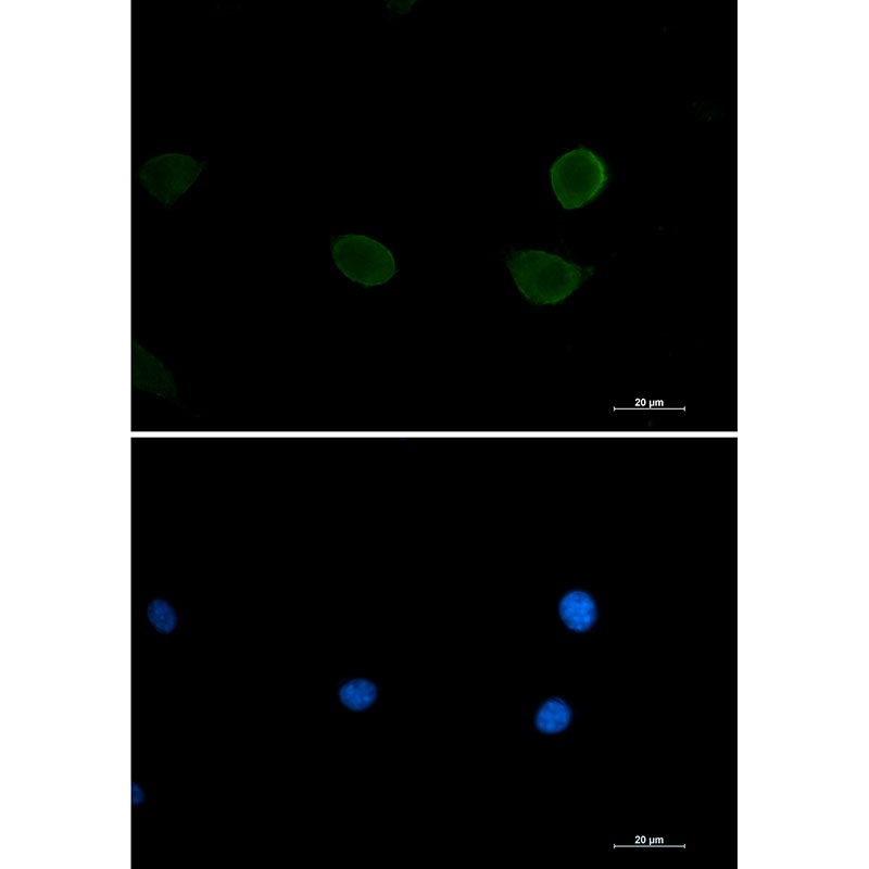 [KO] S6K2 Rabbit mAb