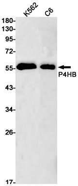 P4HB Rabbit Monoclonal Antibody