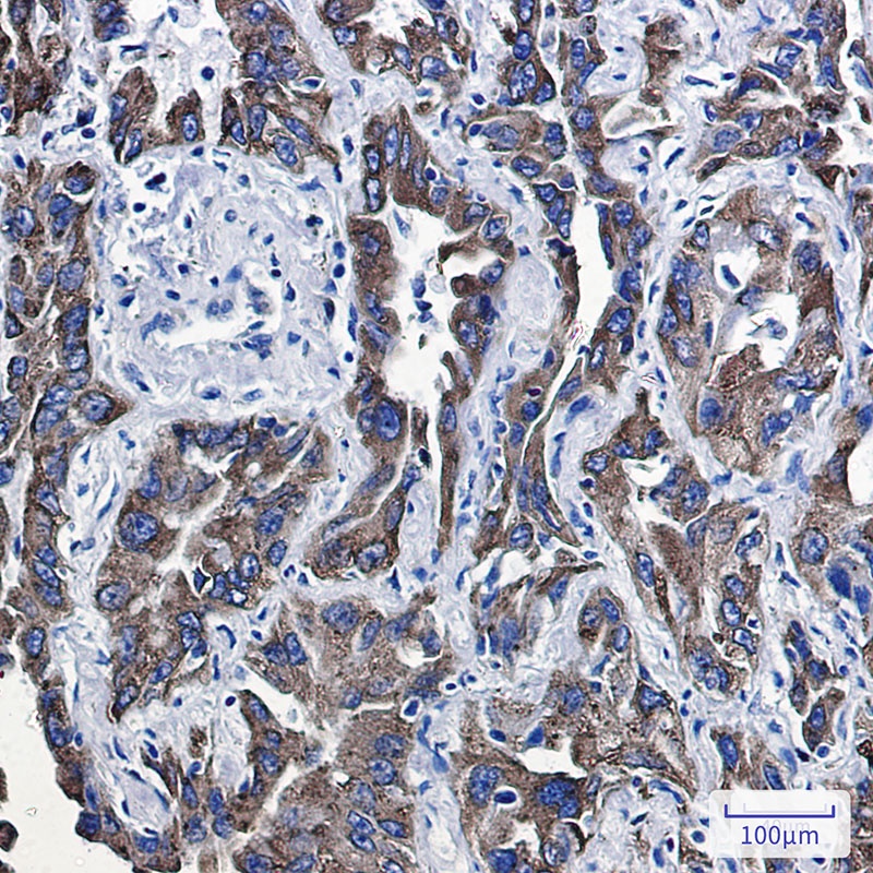 P4HB Rabbit Monoclonal Antibody