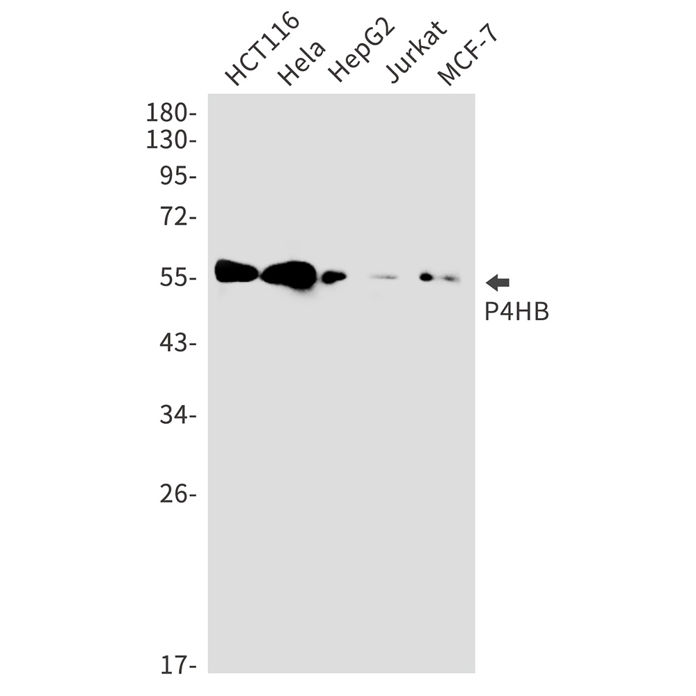 P4HB Rabbit Monoclonal Antibody