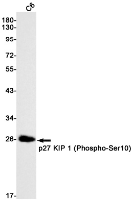 Phospho-p27 KIP 1 (Ser10) Rabbit Monoclonal Antibody