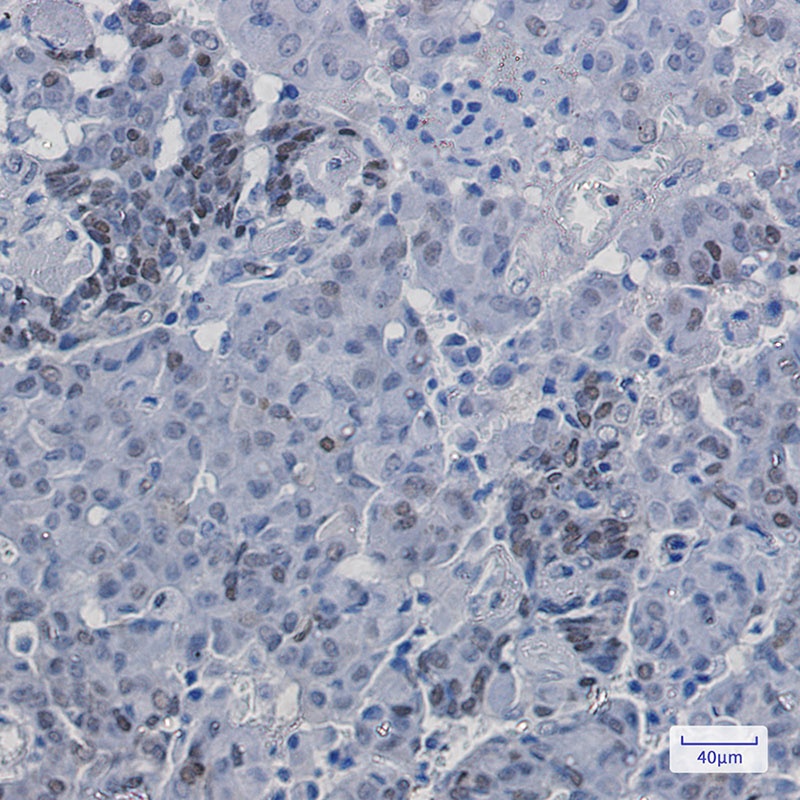 Phospho-p27 KIP 1 (Ser10) Rabbit Monoclonal Antibody