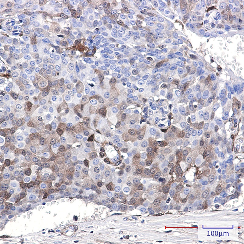 CDKN2C Antibody