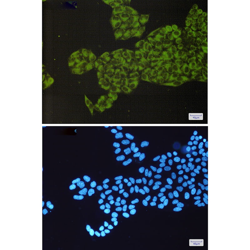 ORP150 Rabbit mAb
