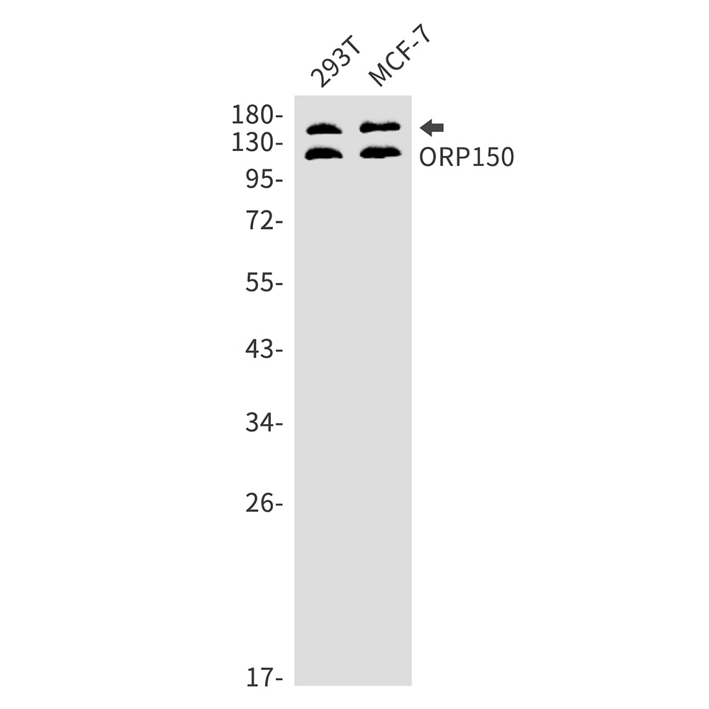 ORP150 Rabbit mAb
