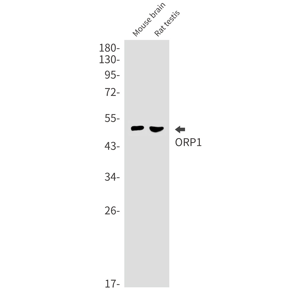 ORP1 Rabbit mAb