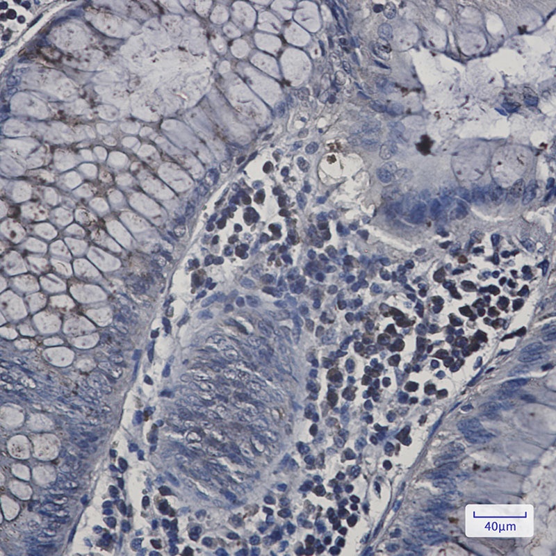 WASL Antibody