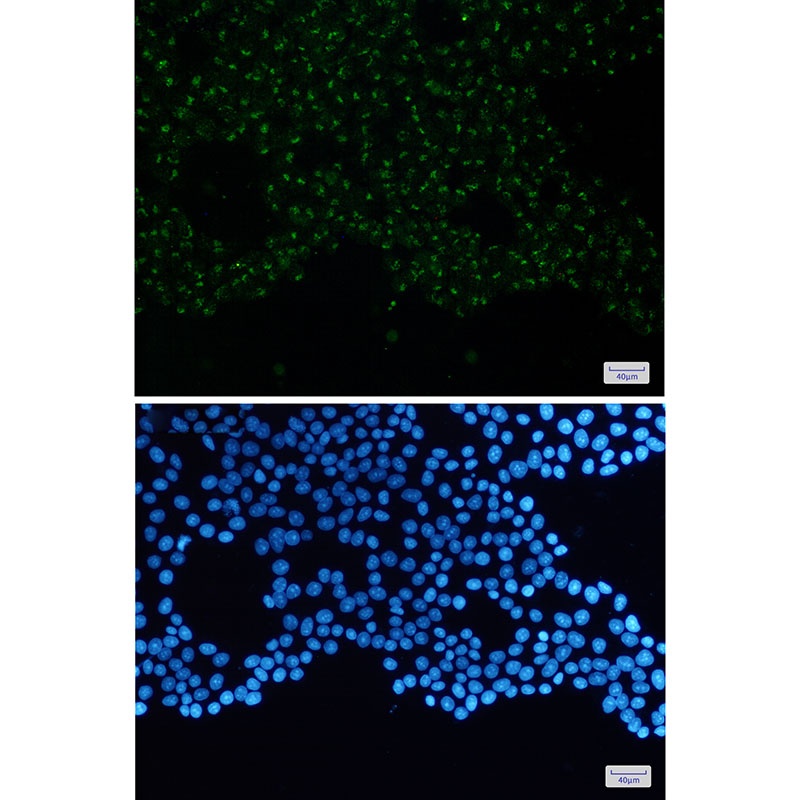 WASL Antibody