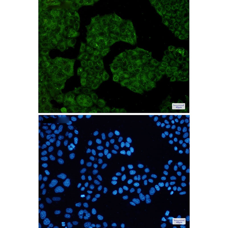 NUDT9 Rabbit mAb