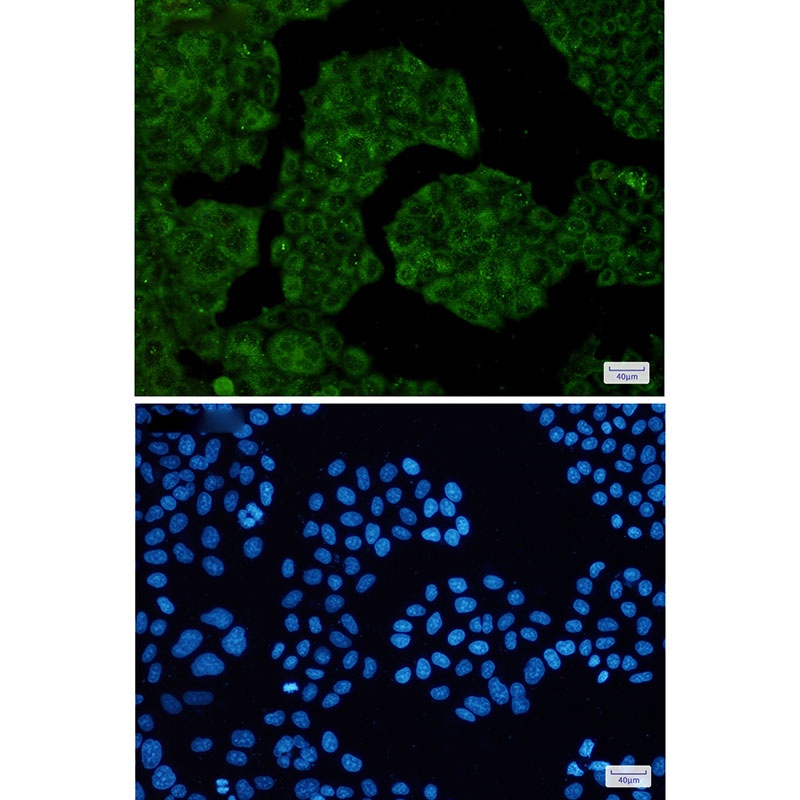 NUDT9 Antibody