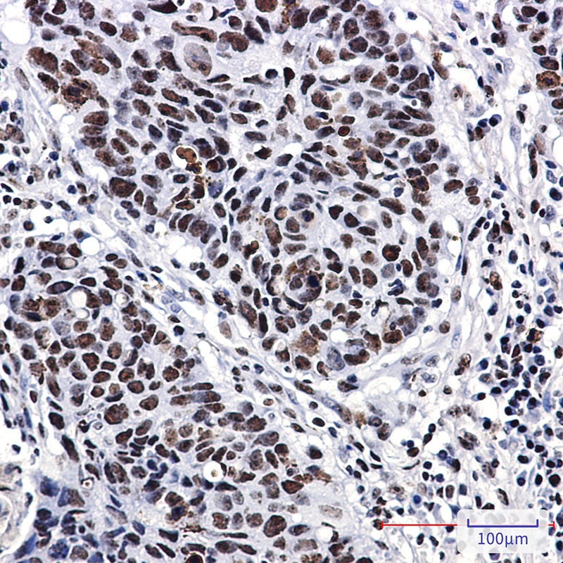NPM1 Antibody