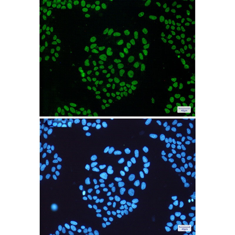 THOC1 Antibody
