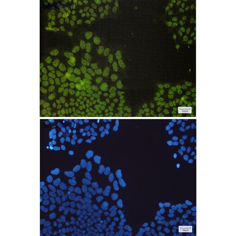Nrf1 Rabbit mAb