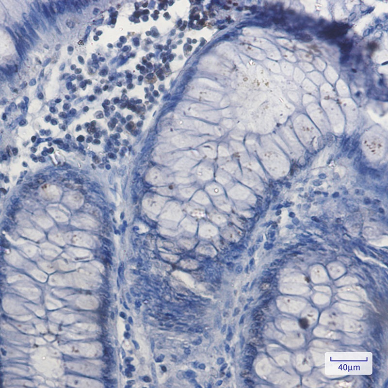 Nrf1 Rabbit mAb