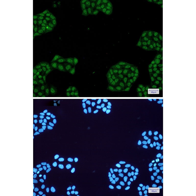 NR1D1 Rabbit mAb