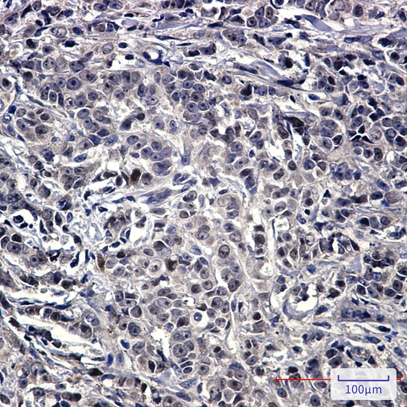 NOLC1 Antibody