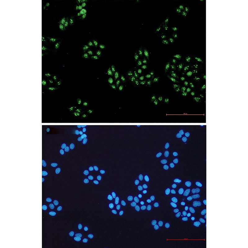 NOLC1 Antibody