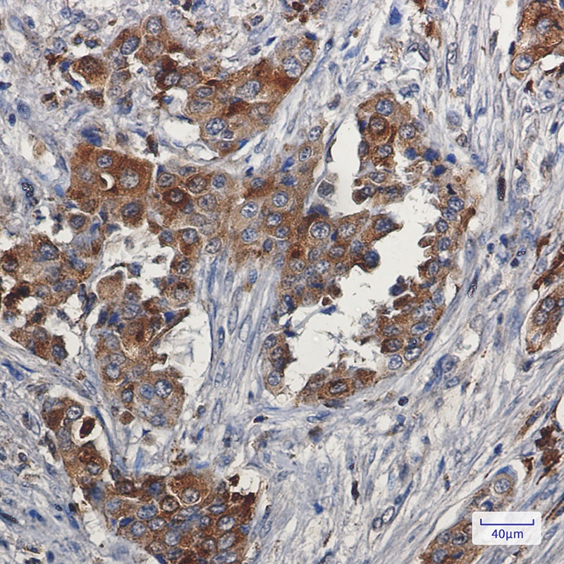 Niemann Pick C2 Rabbit mAb