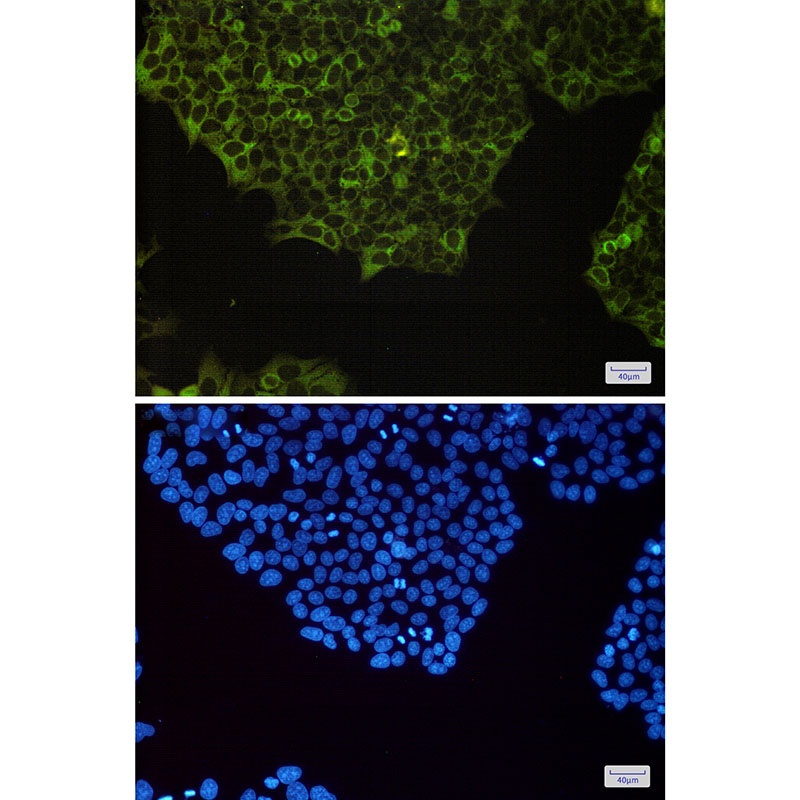 NFKB2 Antibody