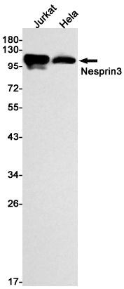 Nesprin3 Rabbit mAb