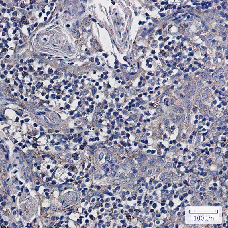 NDUFS6 Antibody