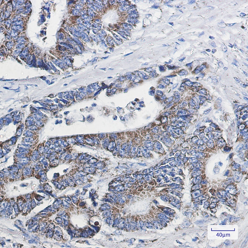 NDUFB10 Antibody