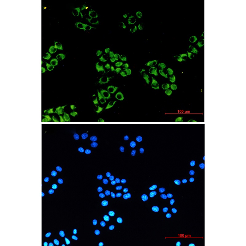 NDUFB10 Antibody