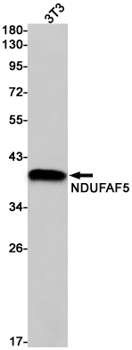 NDUFAF5 Rabbit mAb