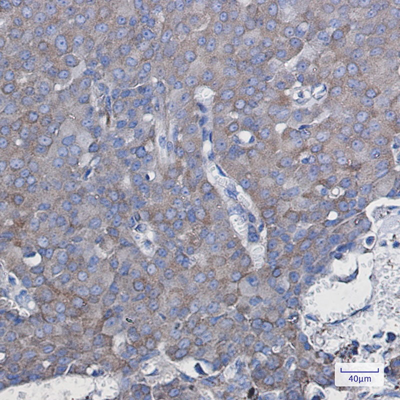 NDUFAF5 Rabbit mAb