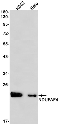 NDUFAF4 Rabbit mAb