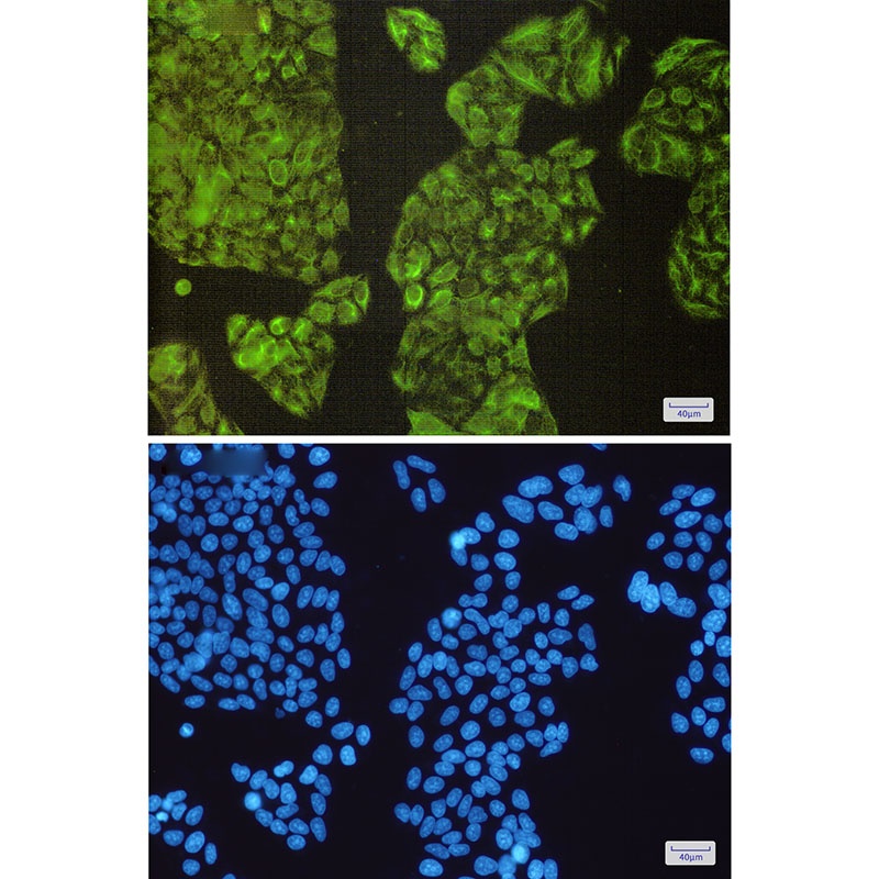 NCK2 Rabbit mAb