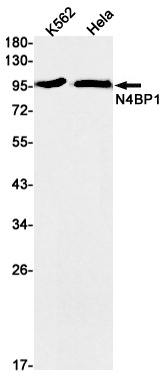 N4BP1 Rabbit mAb